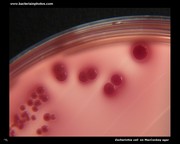 escherichia coli on MacConkey agar